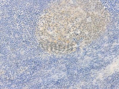 POU2AF1 Antibody - DF7859 at 1/100 staining human normal tonsil tissue by IHC-P.