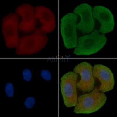 HHEX Antibody - DF7868 staining Hela cells(30min of UV treatment) by IF/ICC.