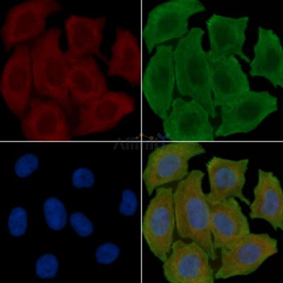 GSTK1 Antibody - DF7869 staining Hela cells(30min of UV treatment) by IF/ICC.