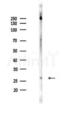TPPP Antibody - Western blot analysis of lysates from Rat brain, using TPPP Antibody at 1/1000 dilution.
