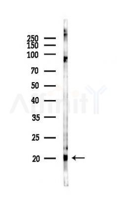 MLC2 Antibody - Western blot analysis of lysates from K562 cells(UV 30min treatment), using MLC2 Antibody at 1/1000 dilution.