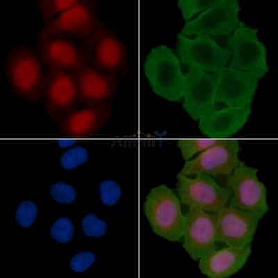 PAX7 Antibody - DF7915 staining Hela cells(30min of UV treatment) by IF/ICC.
