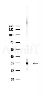 ICAD Antibody - Western blot analysis of lysates from PC12 cells(LPS 4h treatment), using ICAD Antibody at 1/1000 dilution.