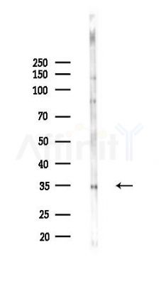 ICAD Antibody - Western blot analysis of lysates from Rat brain, using ICAD Antibody at 1/1000 dilution.