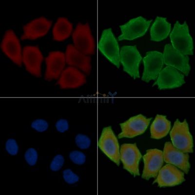 ORAI1 Antibody - DF7956 staining Hela cells(30min of UV treatment) by IF/ICC.