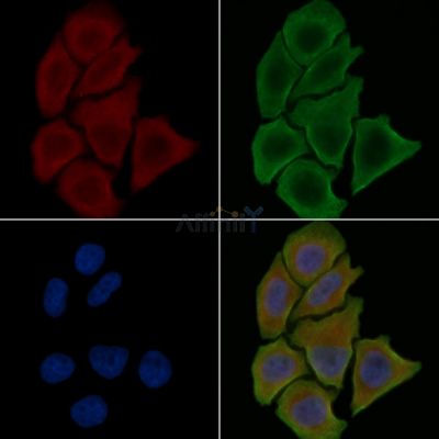 TRPM8 Antibody - DF7966 staining Hela cells(30min of UV treatment) by IF/ICC.