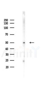 AGT Antibody - Western blot analysis of lysates from Mouse lung, using AGT Antibody at 1/1000 dilution.