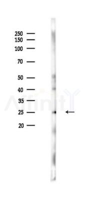 APOD Antibody - Western blot analysis of lysates from Mouse lung, using APOD Antibody at 1/1000 dilution.