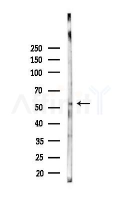 EBF1 Antibody - Western blot analysis of lysates from PC12 cells(starvation 24h treatment), using EBF1 Antibody at 1/1000 dilution.