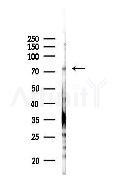 STIM1 Antibody - Western blot analysis of lysates from B16F10-LUC cells(heat-shock 45min treatment), using STIM1 Antibody at 1/1000 dilution.