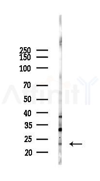 SOCS2 Antibody - Western blot analysis of lysates from Mouse lung, using SOCS2 Antibody at 1/1000 dilution.