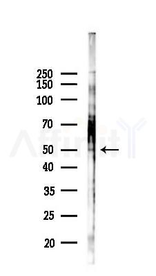 Somatostatin Receptor 5 Antibody - Western blot analysis of lysates from PC12 cells(LPS 4h treatment), using Somatostatin Receptor 5 Antibody at 1/1000 dilution.