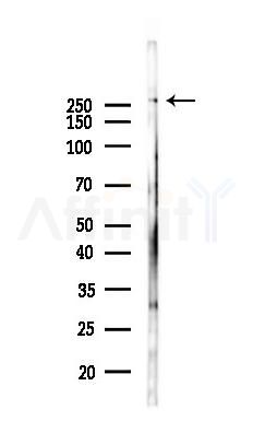 ABCA1 Antibody - Western blot analysis of lysates from PC12 cells(LPS 4h treatment), using ABCA1 Antibody at 1/1000 dilution.
