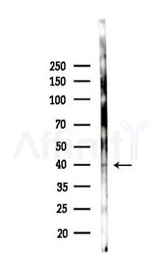 TMOD2 Antibody - Western blot analysis of lysates from A2780 cells(starvation 24h treatment), using TMOD2 Antibody at 1/1000 dilution.