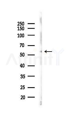 PANX1 Antibody - Western blot analysis of lysates from Rat liver, using PANX1 Antibody at 1/1000 dilution.
