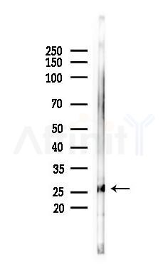NOG Antibody - Western blot analysis of lysates from Mouse lung, using NOG Antibody at 1/1000 dilution.