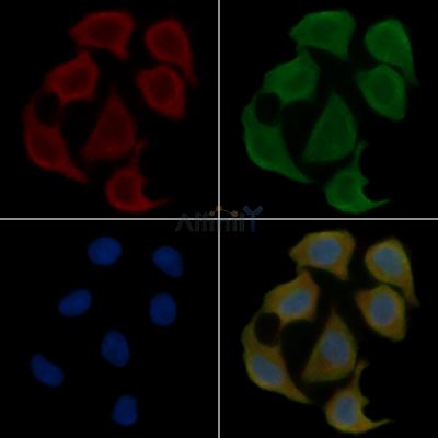 ATG10 Antibody - DF8366 staining Hela cells(30min of UV treatment) by IF/ICC.