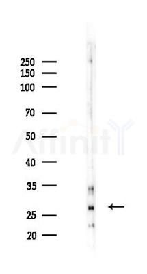 RanBP1 Antibody - Western blot analysis of lysates from COLO205 cells(UV 30min treatment), using RanBP1 Antibody at 1/1000 dilution.