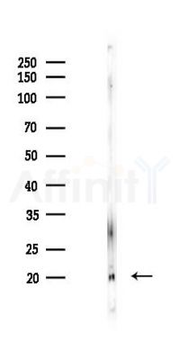 RanBP1 Antibody - Western blot analysis of lysates from PC12 cells(LPS 4h treatment), using RanBP1 Antibody at 1/1000 dilution.