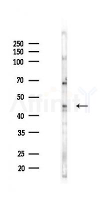 PNLIP Antibody - Western blot analysis of lysates from COLO205 cells(UV 30min treatment), using PNLIP Antibody at 1/1000 dilution.