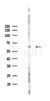 PNLIP Antibody - Western blot analysis of lysates from Mouse lung, using PNLIP Antibody at 1/1000 dilution.