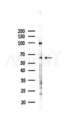 ABCG5 Antibody - Western blot analysis of lysates from PC12 cells(LPS 4h treatment), using ABCG5 Antibody at 1/1000 dilution.