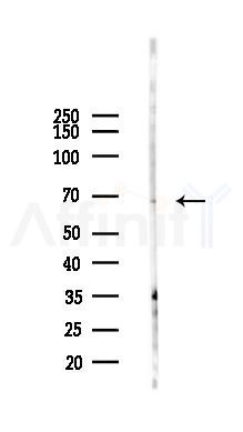 ENC1 Antibody - Western blot analysis of lysates from Hela cells(starvation 24h treatment), using ENC1 Antibody at 1/1000 dilution.