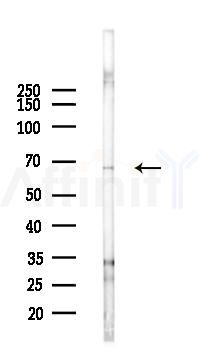 ENC1 Antibody - Western blot analysis of lysates from EC304 cells(starvation 24h treatment), using ENC1 Antibody at 1/1000 dilution.