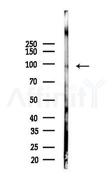 NUP98 Antibody - Western blot analysis of lysates from COLO205 cells(starvation 24h treatment), using NUP98 Antibody at 1/1000 dilution.