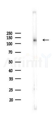 ZNF217 Antibody - Western blot analysis of lysates from Mouse lung, using ZNF217 Antibody at 1/1000 dilution.