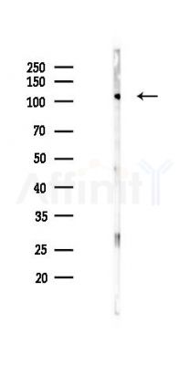 ZNF217 Antibody - Western blot analysis of lysates from PC12 cells(LPS 4h treatment), using ZNF217 Antibody at 1/1000 dilution.