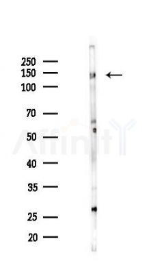 ZNF217 Antibody - Western blot analysis of lysates from COLO205 cells(UV 30min treatment), using ZNF217 Antibody at 1/1000 dilution.