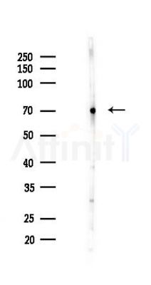 FTO Antibody - Western blot analysis of lysates from COLO205 cells(UV 30min treatment), using FTO Antibody at 1/1000 dilution.