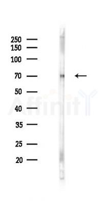 FTO Antibody - Western blot analysis of lysates from PC12 cells(LPS 4h treatment), using FTO Antibody at 1/1000 dilution.