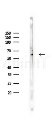 FTO Antibody - Western blot analysis of lysates from Rat testis, using FTO Antibody at 1/1000 dilution.