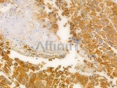 LMAN1 Antibody - DF8460 at 1/100 staining human normal kidney tissue by IHC-P.