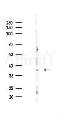 CDC34 Antibody - Western blot analysis of lysates from COLO205 cells(UV 30min treatment), using CDC34 Antibody at 1/1000 dilution.