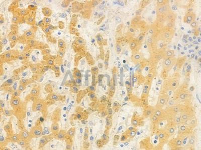 IDH3B Antibody - DF8562 at 1/100 staining human normal liver tissue by IHC-P.