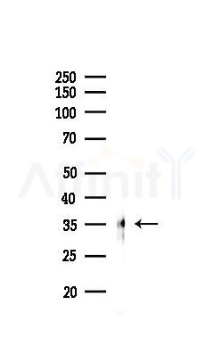 Pax-9 Antibody - Western blot analysis of lysates from PC12 cells(LPS 4h treatment), using Pax-9 Antibody at 1/1000 dilution.