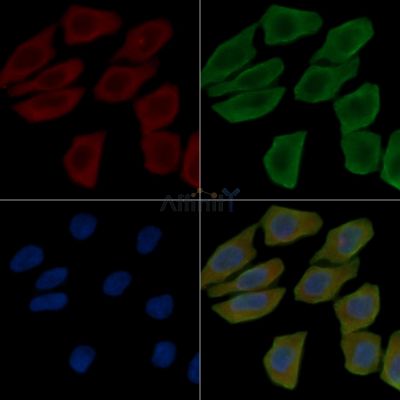 PDLIM5 Antibody - DF8590 staining Hela cells(30min of UV treatment) by IF/ICC.
