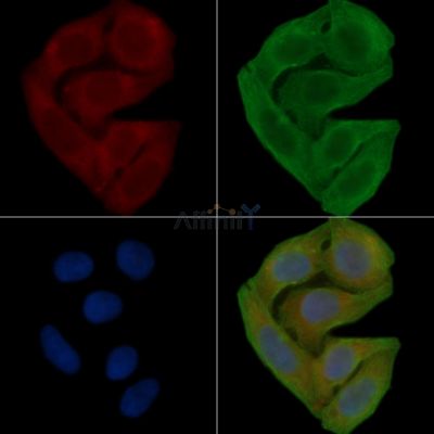 Podocin Antibody - DF8593 staining Hela cells(30min of UV treatment) by IF/ICC.