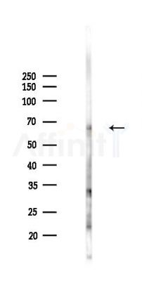 Serotonin transporter Antibody - Western blot analysis of lysates from Mouse lung, using Serotonin transporter Antibody at 1/1000 dilution.