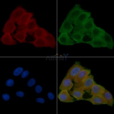 FAKD2 Antibody - DF8656 staining Hela cells(24h of starvation treatment) by IF/ICC.