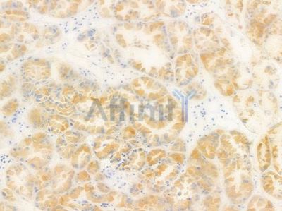 RPL14 Antibody - DF8718 at 1/100 staining human normal kidney tissue by IHC-P.