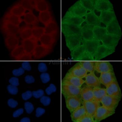 RPL14 Antibody - DF8718 staining Hela cells(30min of UV treatment) by IF/ICC.