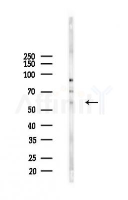 SRPK3 Antibody - Western blot analysis of lysates from 293 cells(starvation 24h treatment), using SRPK3 Antibody at 1/1000 dilution.