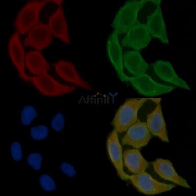 TPH2 Antibody - DF8732 staining Hela cells(30min of UV treatment) by IF/ICC.