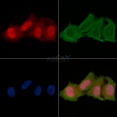 Phospho-Casein Kinase 1 alpha (Tyr294) Antibody - DF8736 staining Hela cells(24h of starvation treatment) by IF/ICC.
