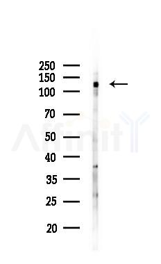 Phospho-JIP1 (Thr103) Antibody - Western blot analysis of lysates from A2780 cells(starvation 24h treatment), using Phospho-JIP1 (Thr103) Antibody at 1/1000 dilution.