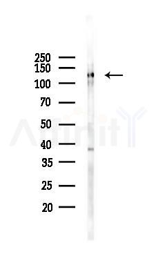 Phospho-JIP1 (Thr103) Antibody - Western blot analysis of lysates from K562 cells(heat-shock 45min treatment), using Phospho-JIP1 (Thr103) Antibody at 1/1000 dilution.